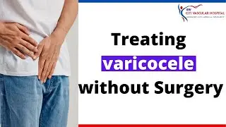 Varicocele Treatment | Treating Varicocele Without Surgery in Hyderabad