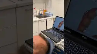 3d сканирование зубов в стоматологии imed Бутово, Москва