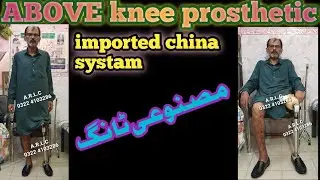 Above knee short stamp artificial leg with hipjoint belt #ottobock #prosthetics #viralvideo  #limb