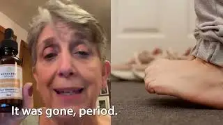 Janice shares her experience with FAST pain relief from Frankincense oil. #safe #naturalpainrelief