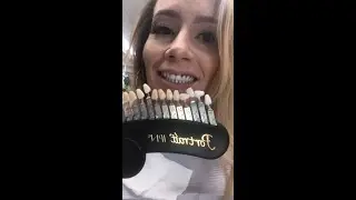 PICKING MY NEW TEETH? & Updates!