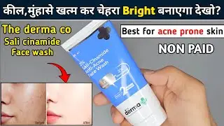 The Derma Co Anti Acne Face Wash | the derma co sali cinamide face wash | derma co face wash