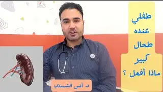 تضخم الطحال عند الأطفال… هل يعني مرض خطير؟!؟