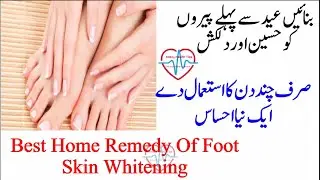 Best Home Remedy Of Foot Skin Whitening | Kazy Health Tips
