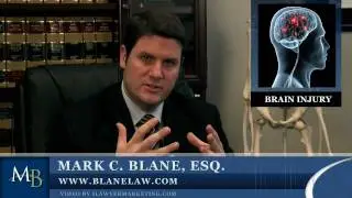 San Diego Brain Injury Lawyer, Head Trauma Attorney - Win Your Brain Injury/Trauma Case Video.mov