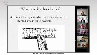 Controversy: Is DK Crush the Gold Standard for complex distal LM stenosis?         No