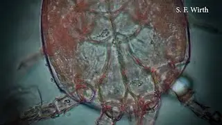 Leg muscle activities in a deutonymph of mite Histiostoma sp.