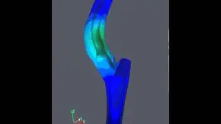 ISOGEOMETRIC ANALYSIS FOR VASCULAR BIOMECHANICS: A TEST-CASE STUDY