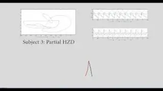 First Steps Toward Automatically Generating Bipedal Robotic Walking from Human Data