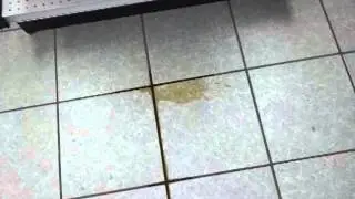 gross stuff people do