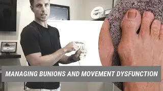 Managing Bunions and Movement Dysfunction