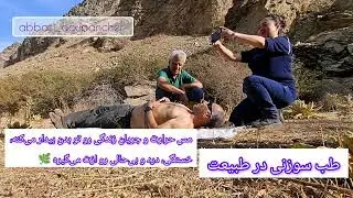  #طب_سوزنی#درمان_طبیعی#درمان_درد#acupuncture#acupuncturetherapy#traditionalchinesemedicine#