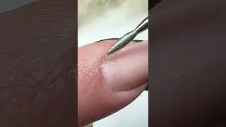 Achtung beim Fr&auml;sen der Nagelhaut
