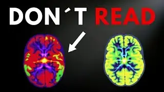 How to destroy your brain in 30 days (my self experiment)