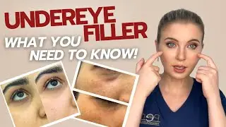 Under Eye Filler Explained: Uses, Results, Side Effects & Skincare Tips - Dr Einas Mousa | Dubai