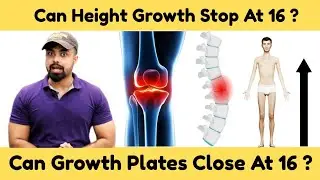 Reasons Why Height Growth Can Stop At 16 ? Growth Plates Open Or Close | Signs That Stop Height 