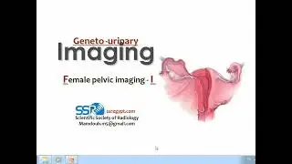 Imaging of the female pelvis (I) (DRE) Prof. Mamdouh Mahfouz
