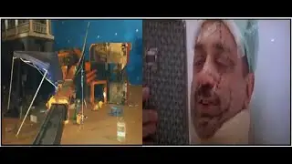Kamal Hassan got injured due to an accident on the set of film 