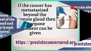 Best Alternative Treatments for Prostate Cancer