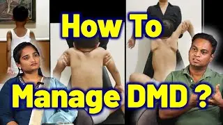 How to Manage DMD Diseases? | Duchenne Muscular Dystrophy Treatment Medicine  | Neurology Psychiatry