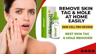 Skin Tag Removal Product Reviews | Skin Cell Pro Review  Skin Tag Removal at Home
