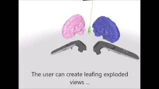 Medical image atlas visualization and interaction in VR