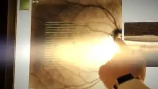 Bowden Eye & Associates- Diabetic Eyecare, Retinopathy