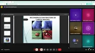 8. Fracturas de cadera y f&eacute;mur