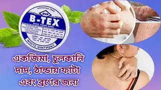 B tex ! Btex ! B-tex ointment ! বি টেক্স মলম কি, কি কাজ করে । ব্যবহারের নিয়ম সম্পূর্ণ তথ্য