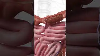 What Constipation Looks Like | 3D Animation