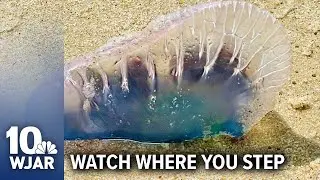 Beachgoer stung by Portuguese man-of-war