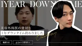 【美容整形】美容外科医が骨切り手術を受けて１年経ちました〜ダウンタイム記録〜【骨切り輪郭３点】