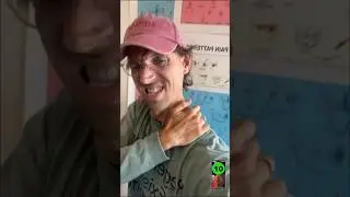 У него была боль в шее, а потом