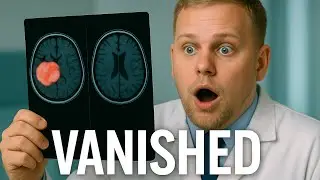 Top 13 Medically-Documented MIRACLES