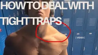How To Deal with TIGHT TRAPS! 