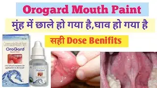 Orogard Mouth Paint ke Faydd | मुंह में छाले हो घाव हो तुरन्त आराम करे | Orogard mouth Pain Dose 