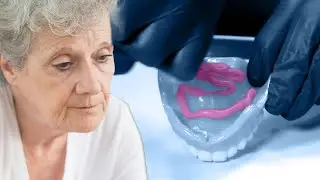 No More Glue! Why Permanent Dental Implants Are a Game Changer