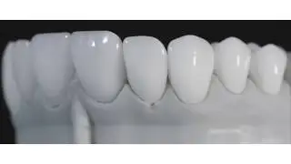 SEVIL ELITE WHITE MONO