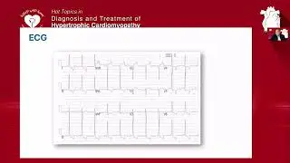 ECS Webinar 7 1 2026