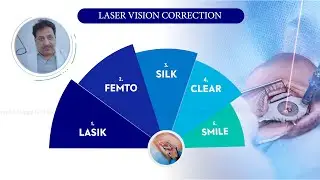 No More Glasses! How Laser Vision Correction Can Change Your Life | CLEAR | SMILE | LASIK LASER