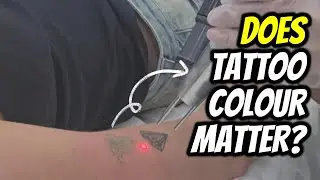 Does Tattoo Colour Matter | Tattoo Removal Explained