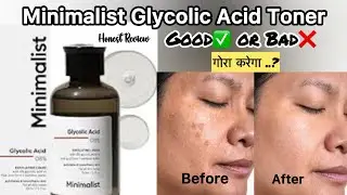 Minimalist Glycolic Acid Toner Review|How to Use + Results|Best Glycolic Acid Toner for Glowing Skin