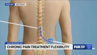 Bill gives chronic pain patients more flexibility with doctor visits, prescriptions