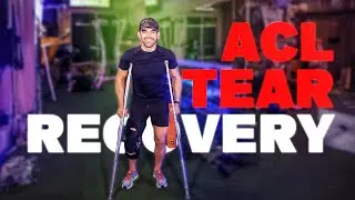 Can I Recover From a Full ACL TEAR? | My ACL TEAR Recovery Protocol