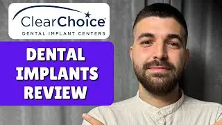 Обзор дентальных имплантатов ClearChoice