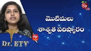 Acne - Treatment | మొటిమలు &ndash; శాశ్వత పరిష్కారం | Dr.ETV | 8th Aug 2022 | ETV Life