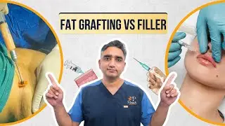 Fillers or Fat Grafting? Benefits, Before-After & Best Candidates Explained