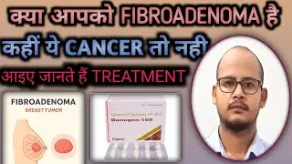 Fibroadenoma Breast Treatment Without Surgery | Fibroadenoma Kya Hota Hai