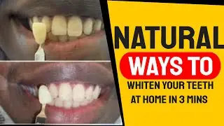 Natural Ways To Whiten Your Teeth | At home in 3 mins