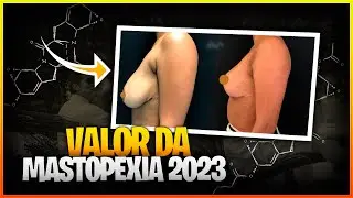 VALOR DA MASTOPEXIA PARA 2023 #mastopexia #valores